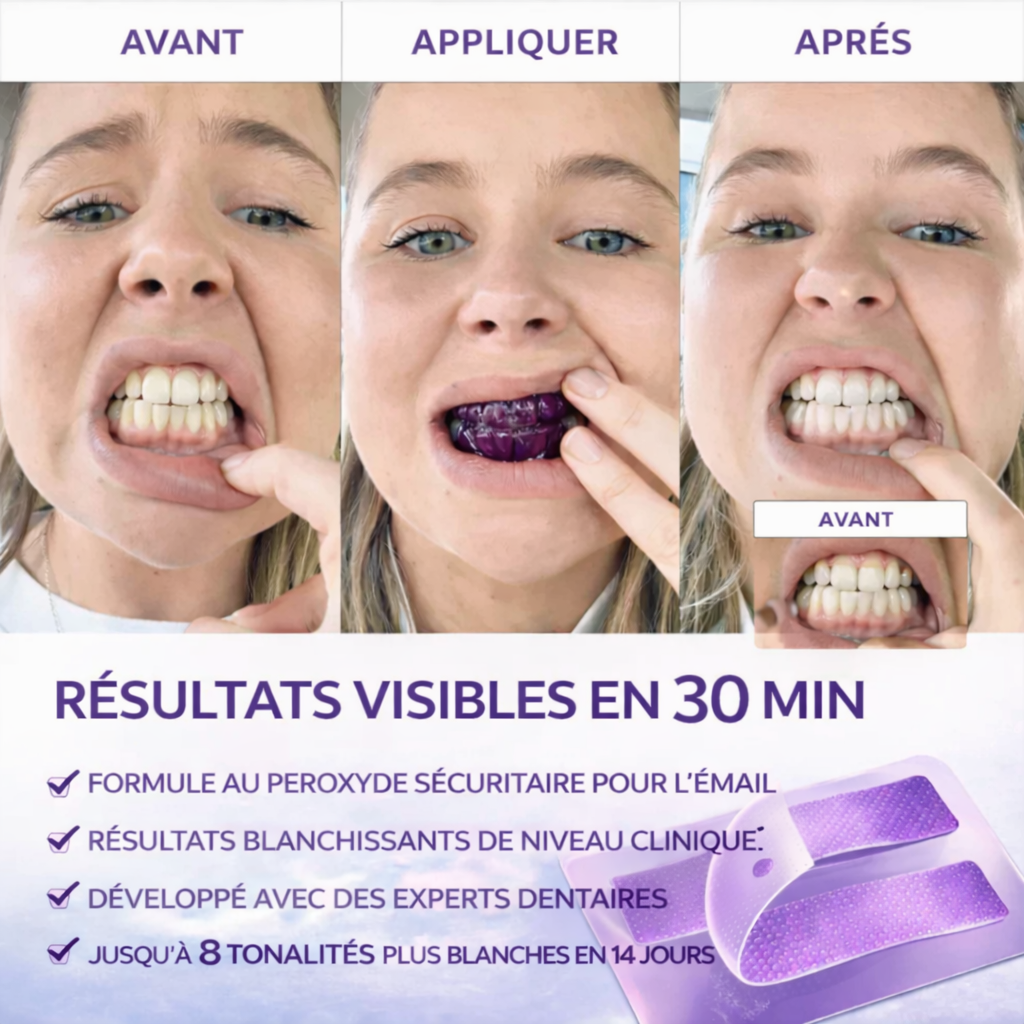 (New) Bandes Dentaires Violettes Anti-Jaunissement "Formule Concentré" ⭐️ - ventix