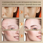 Sérum Reductor de Poros PRO-LISS – Reparación, Firmeza y Control Total