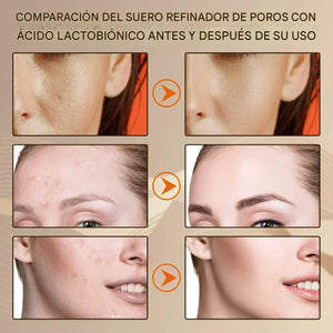 Sérum Reductor de Poros PRO-LISS – Reparación, Firmeza y Control Total