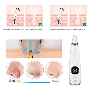 ClearSkin™ – Removedor Eléctrico de Espinillas y Limpiador de Poros Profesional