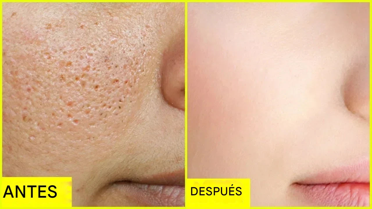 Sérum Reductor de Poros PRO-LISS – Reparación, Firmeza y Control Total