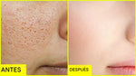 Sérum Reductor de Poros PRO-LISS – Reparación, Firmeza y Control Total