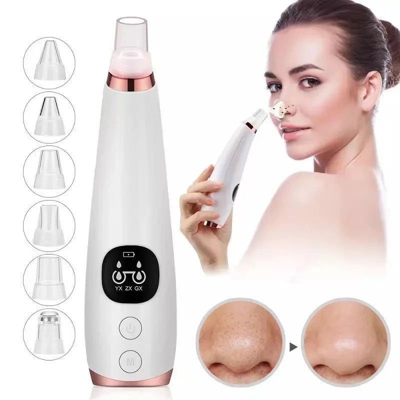 ClearSkin™ – Removedor Eléctrico de Espinillas y Limpiador de Poros Profesional