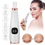 ClearSkin™ – Removedor Eléctrico de Espinillas y Limpiador de Poros Profesional