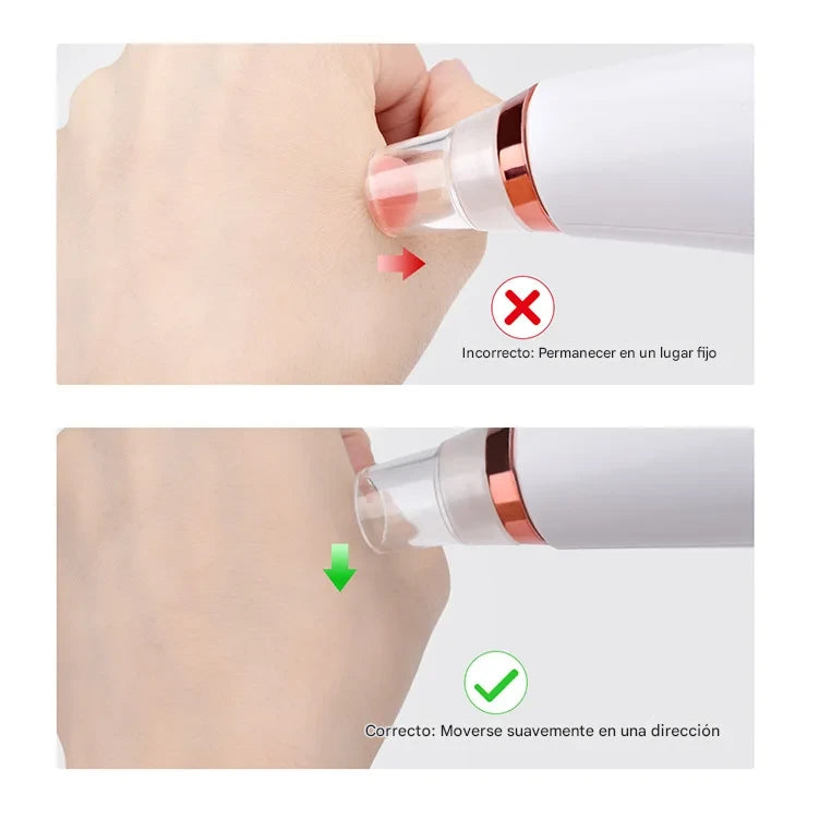 ClearSkin™ – Removedor Eléctrico de Espinillas y Limpiador de Poros Profesional