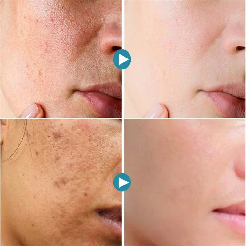 Sérum Reductor de Poros PRO-LISS – Reparación, Firmeza y Control Total