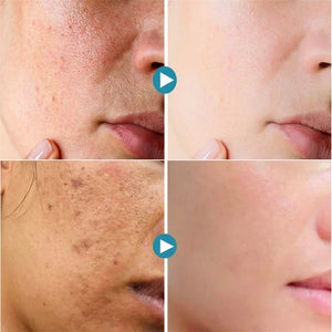 Sérum Reductor de Poros PRO-LISS – Reparación, Firmeza y Control Total
