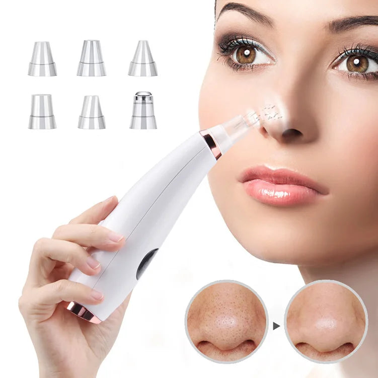 ClearSkin™ – Removedor Eléctrico de Espinillas y Limpiador de Poros Profesional
