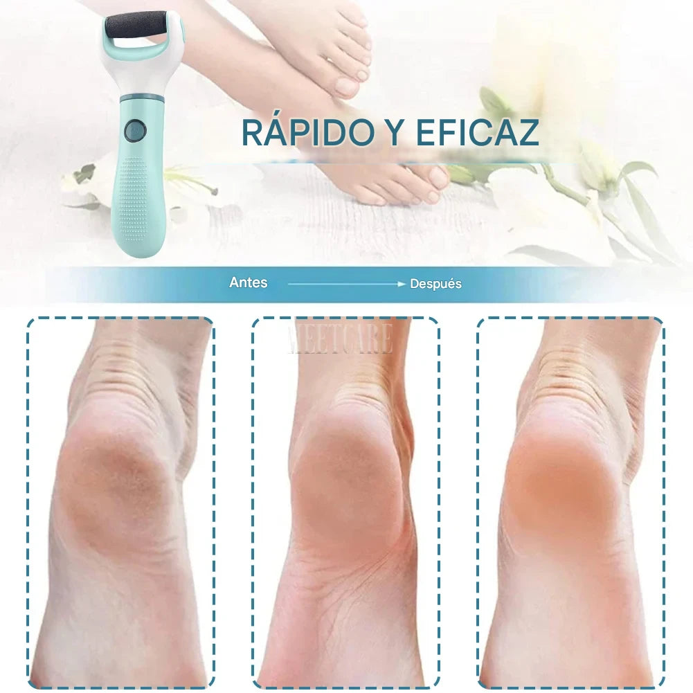 SilkSole™ – Molinillo Eléctrico Inalámbrico para Pies | Eliminador de Callos y Piel Muerta
